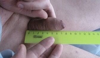 Meting van de grootte van de penis